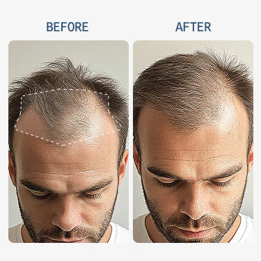 Finally — A Hair Regrowth Solution That Actually Works (Backed by Science)