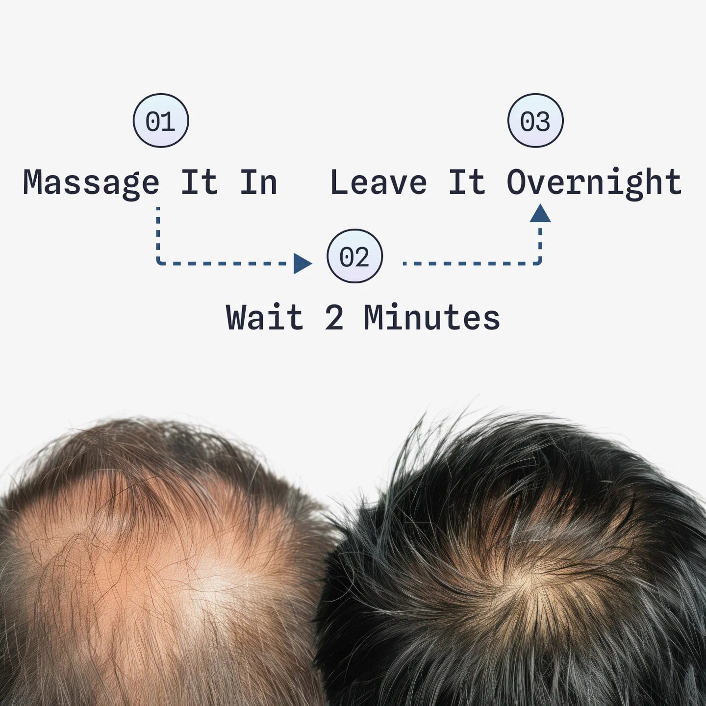 Finally — A Hair Regrowth Solution That Actually Works (Backed by Science)